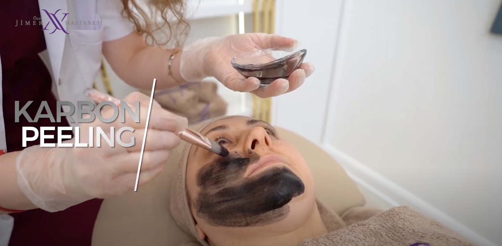 Carbon Peeling Skin Care and Skin Rejuvenation with Q-Switch Laser