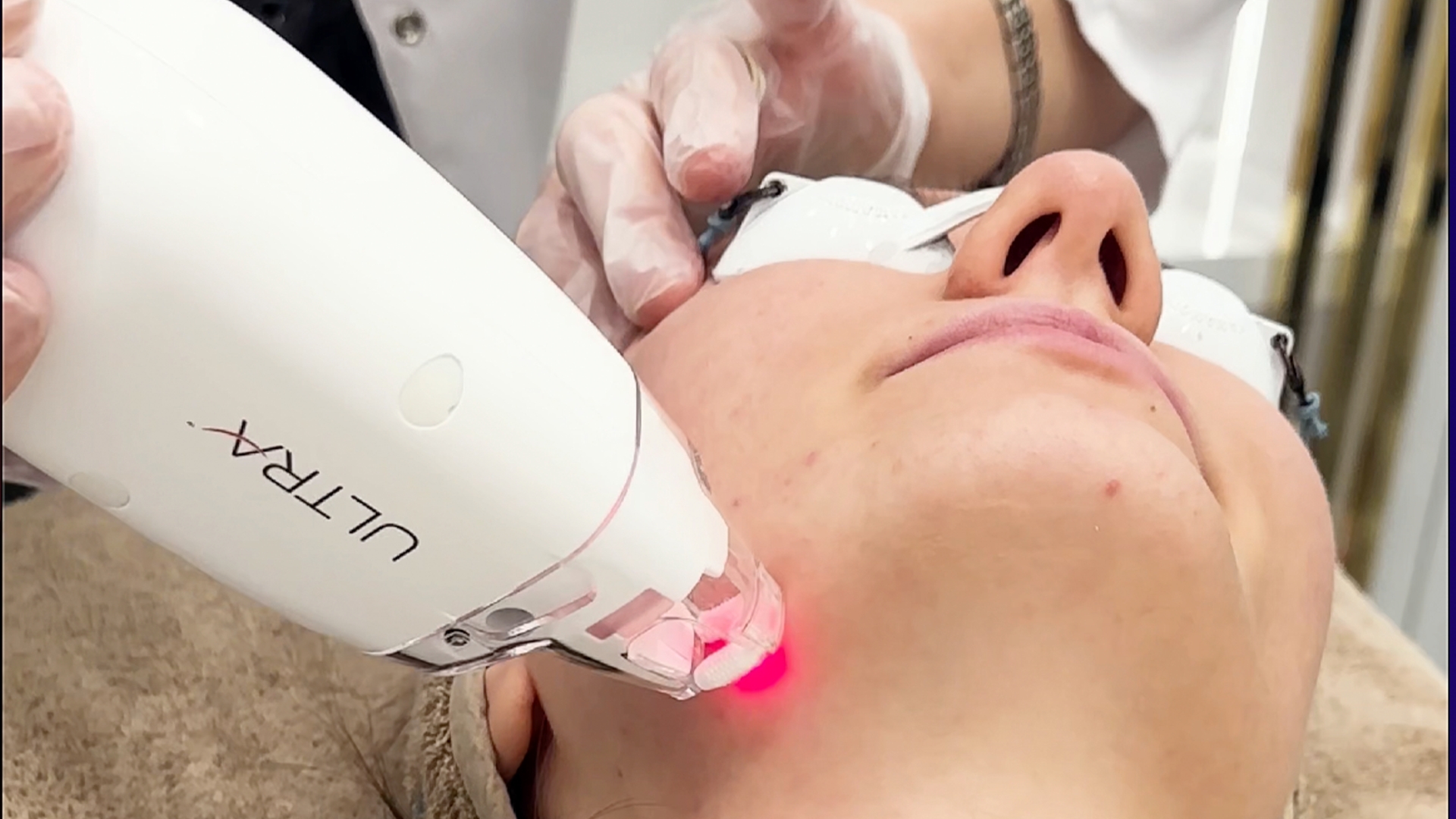 Baby Face Ultra; Miraculous Change in Your Skin!